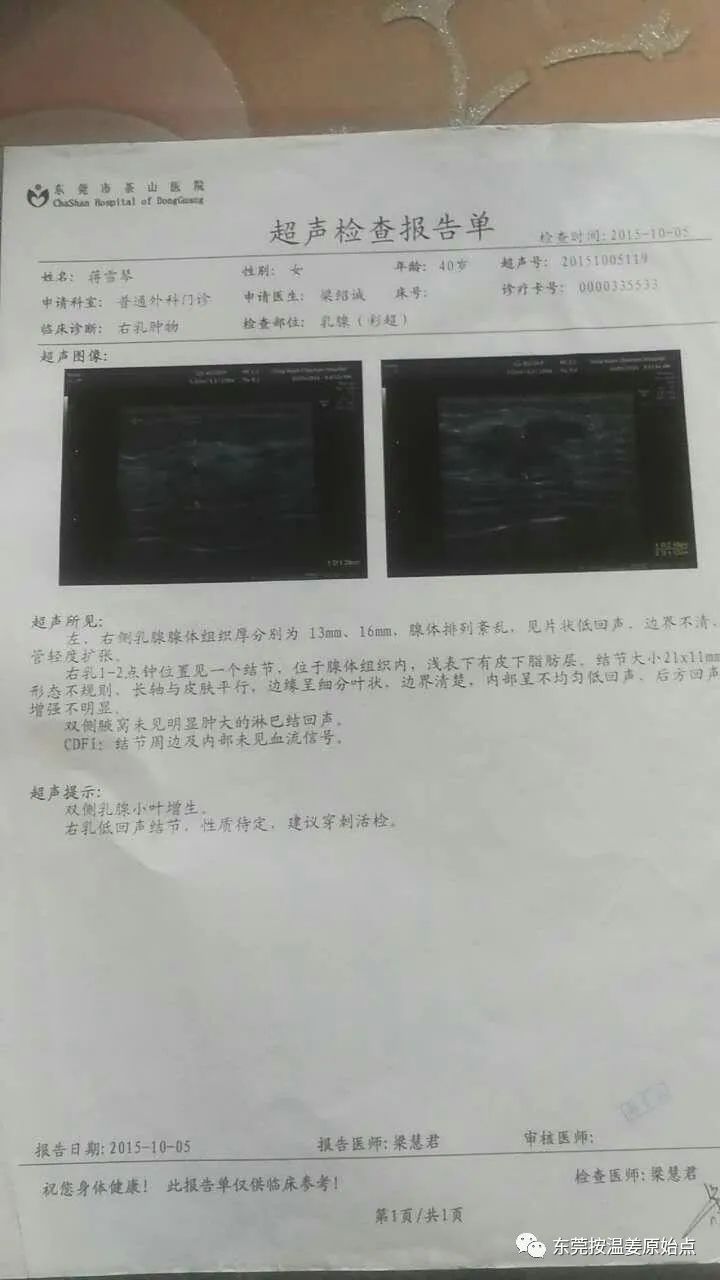 原始点调理乳腺癌 原始点调理乳腺癌