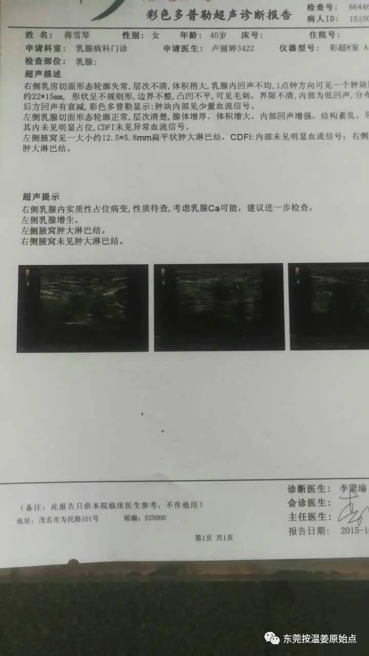 原始点调理乳腺癌 原始点调理乳腺癌