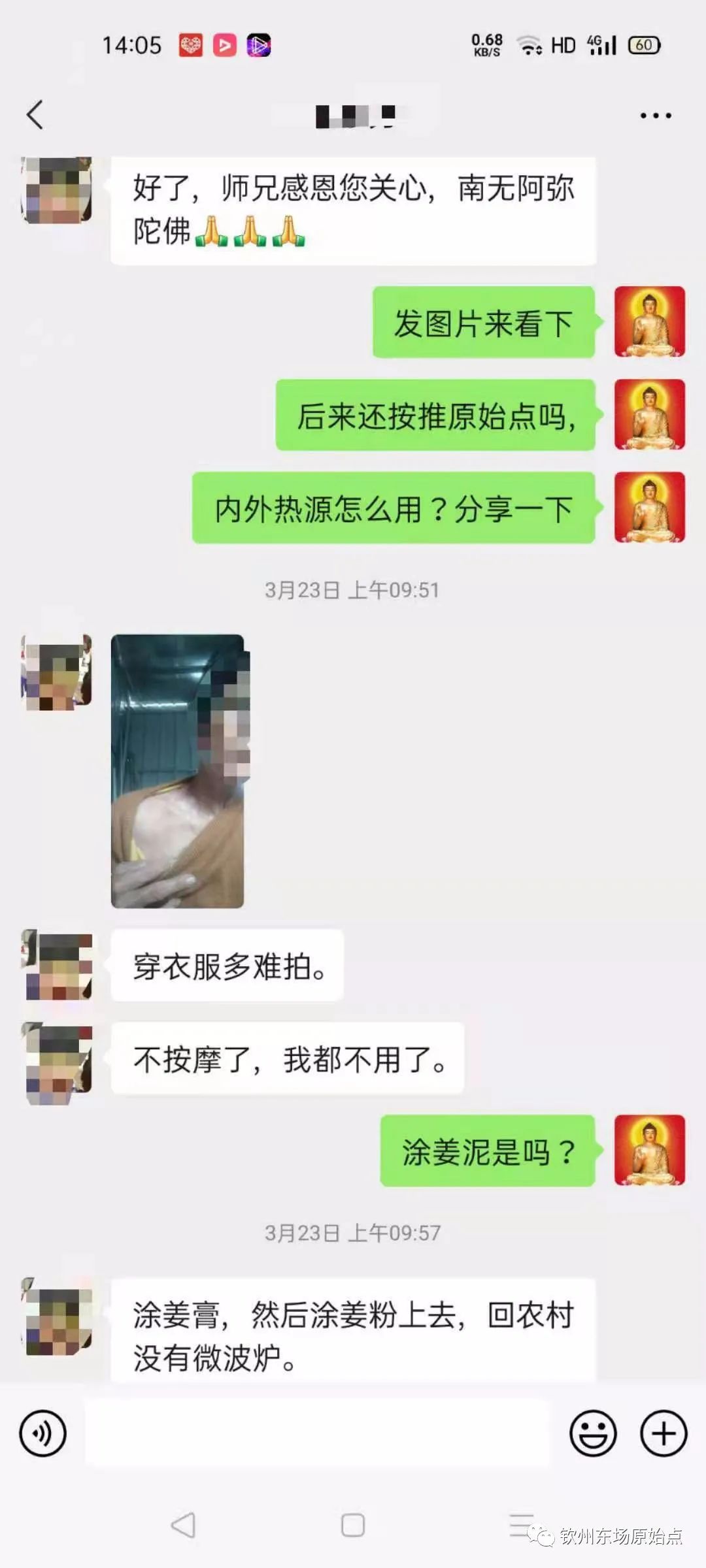 带状疱疹案例 带状疱疹案例