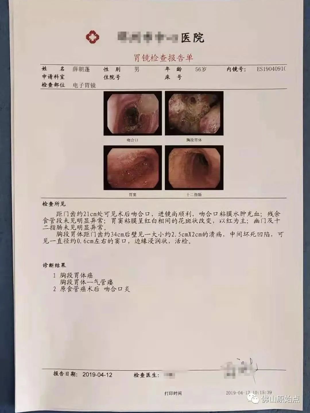 本中心学员花开河南:原始点调理食道癌胃癌胃穿孔案例 本中心学员花开河南:原始点调理食道癌胃癌胃穿孔案例