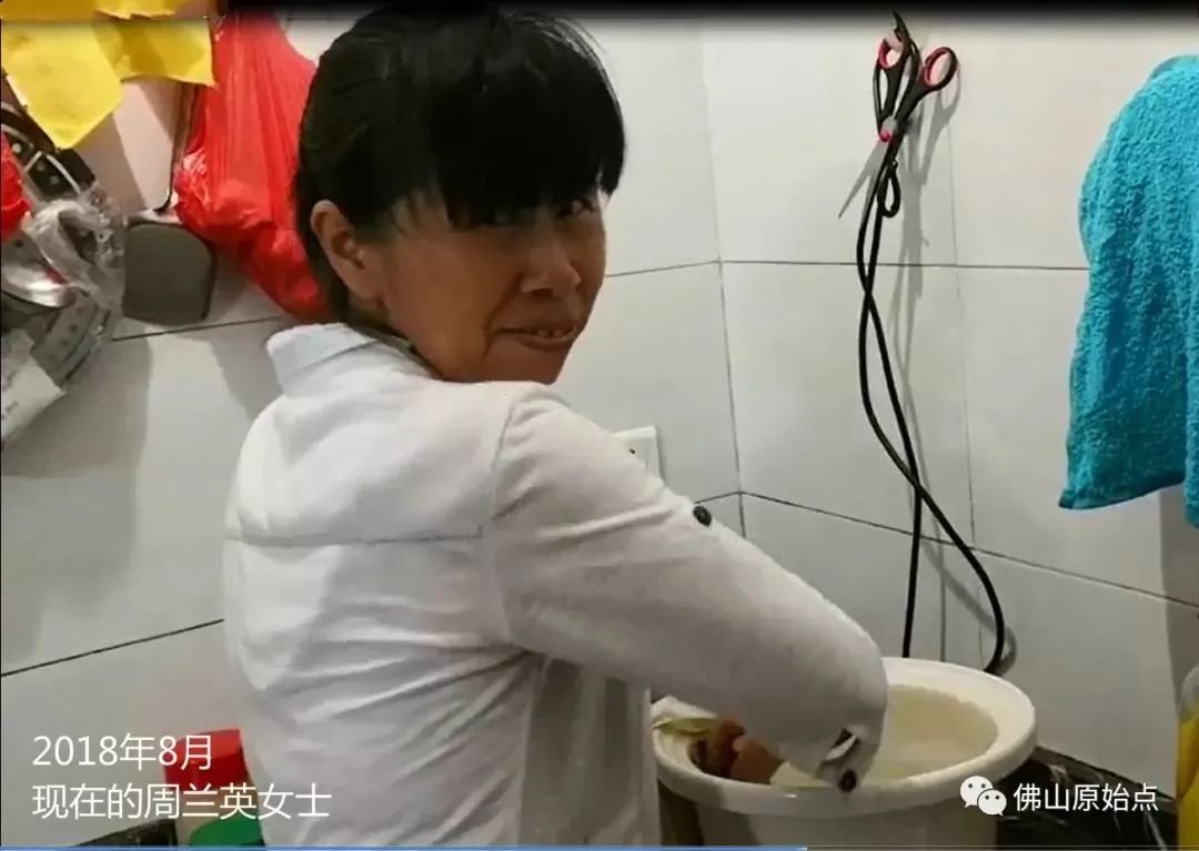 原始点调理脑血管瘤脑出血后遗症一年后回访录:周兰英 原始点调理脑血管瘤脑出血后遗症一年后回访录:周兰英