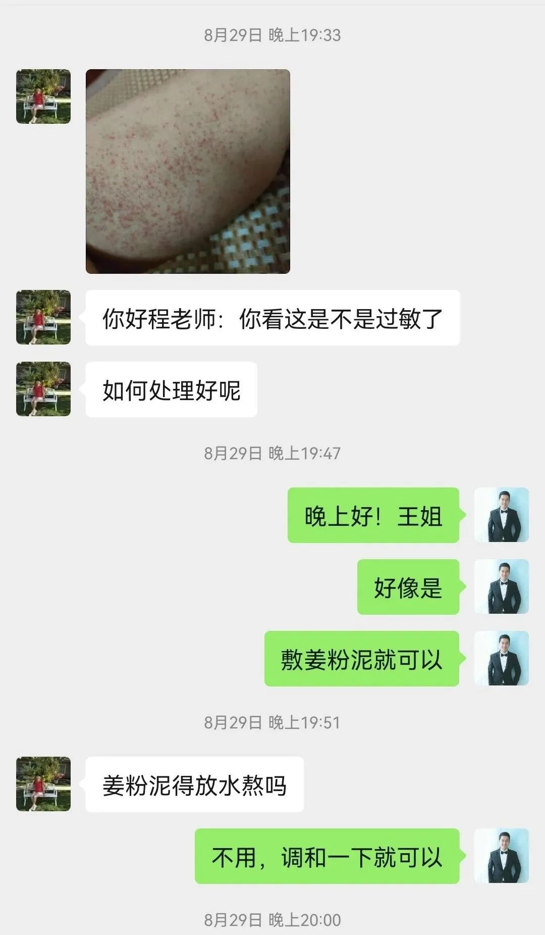 术后药物引起皮肤过敏案例