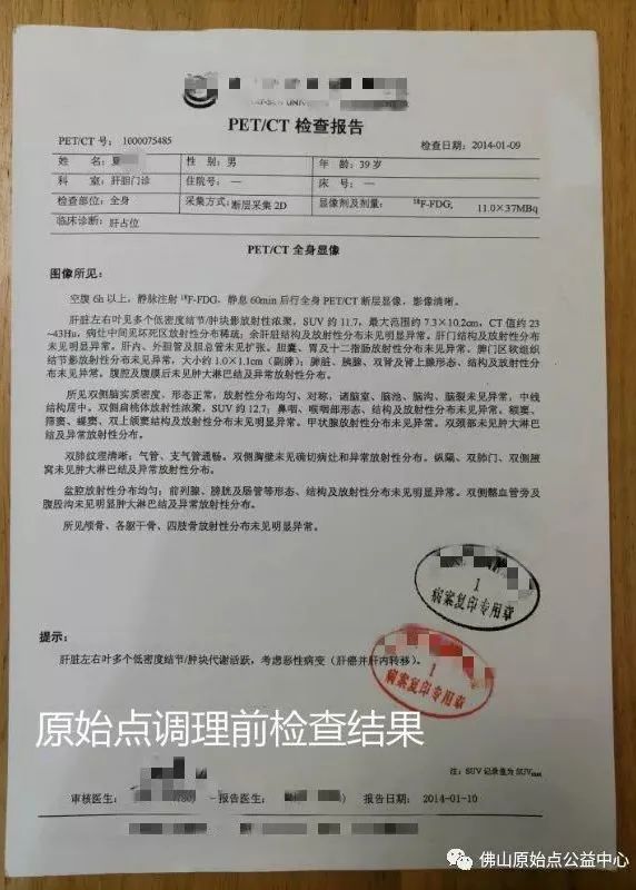 原始点调理肝癌四年后回访录:夏先生 原始点调理肝癌四年后回访录:夏先生