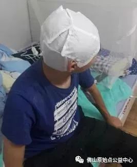 原始点调理九年史牛皮癣:二十天大变化 原始点调理九年史牛皮癣:二十天大变化