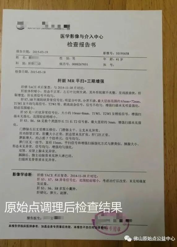 原始点调理肝癌四年后回访录:夏先生 原始点调理肝癌四年后回访录:夏先生